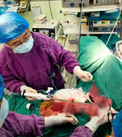 金牛在线 湘雅三医院心胸外科联合多学科协作攻坚复杂食管癌手术